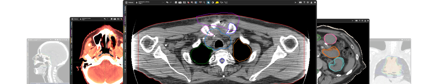 Screen images of medical scans in a center cascading position.