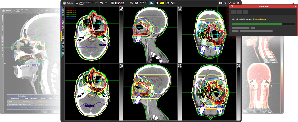 Solve the Challenges of Reirradiation