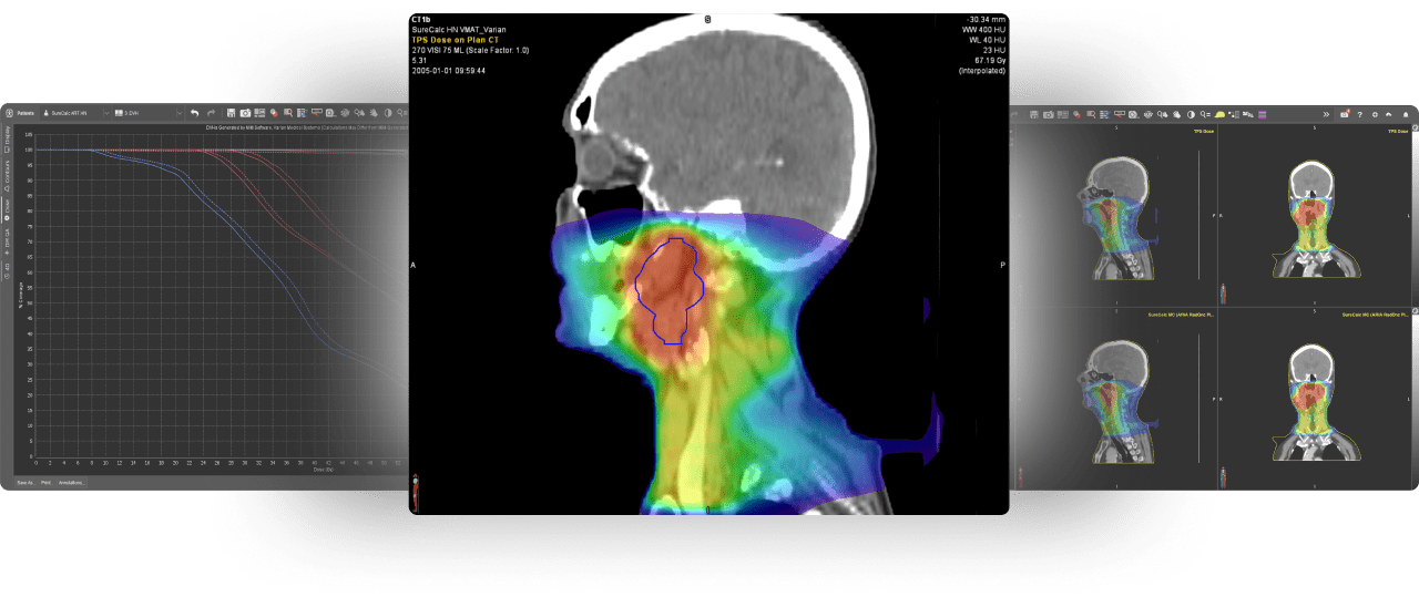 Three medical images of a graph, a side view of a head, and a 4 quadrant view of a head. 