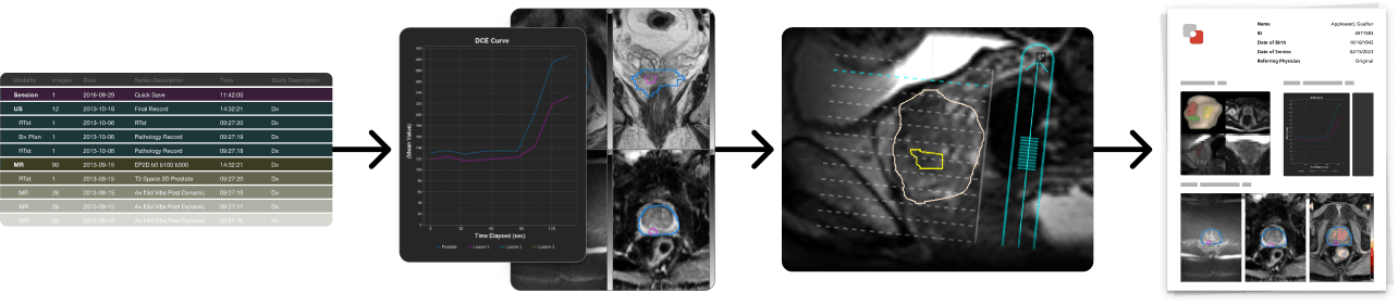 Flow graphic starting with a data table, into a line graph and medical scan, into a medical scan with contours, into a image of a report.
