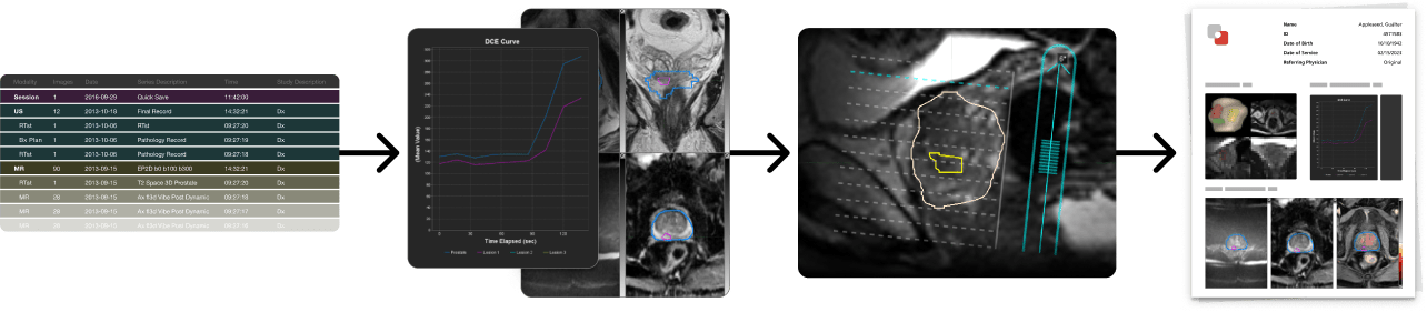 Flow graphic starting with a data table, into a line graph and medical scan, into a medical scan with contours, into a image of a report.