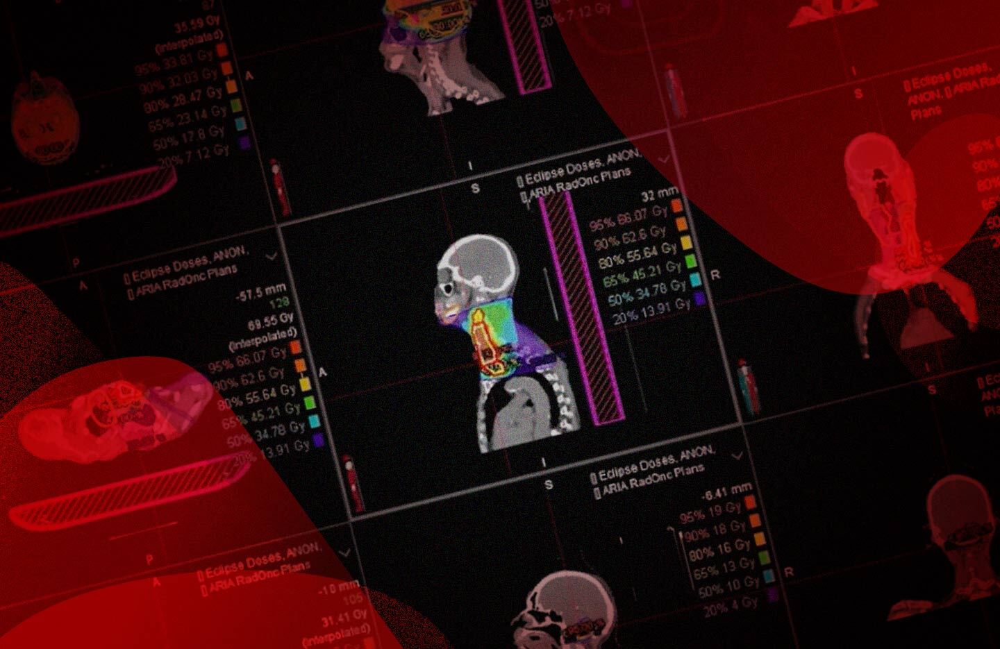 Medical scan with red organic shapes overlaying the corners. 