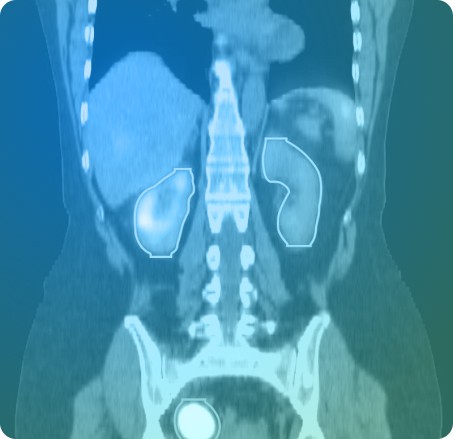 Blue to green image of a body scan, showing the organs of a human being. 