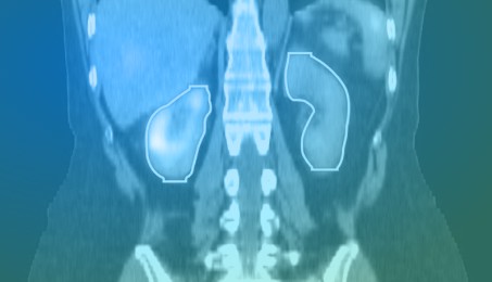 Blue to green image of a body scan, showing the organs of a human being. 