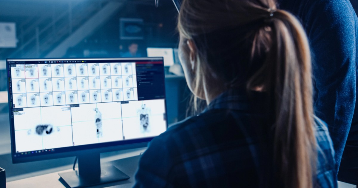 6 Considerations for Implementing Quantitative SPECT Imaging into Your ...