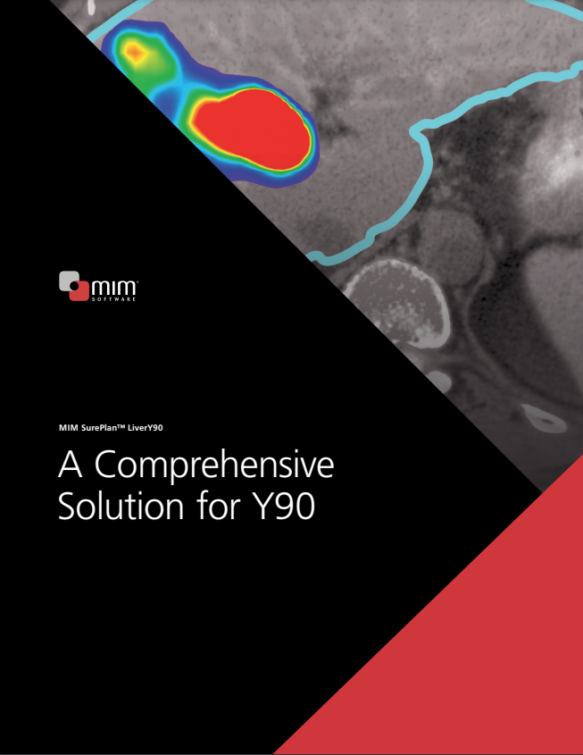  A Comprehensive Solution for Y90 - MIM SurePlan™ LiverY90 (PDF)