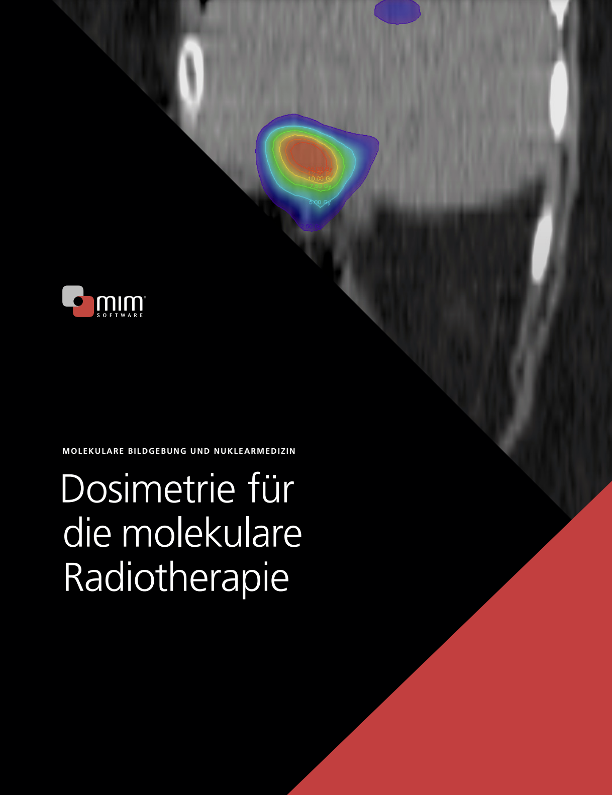 Molekulare Bildgebung Und Nuklearmedizin – Dosimetrie Für Die Molekulare Radiotherapie (PDF)