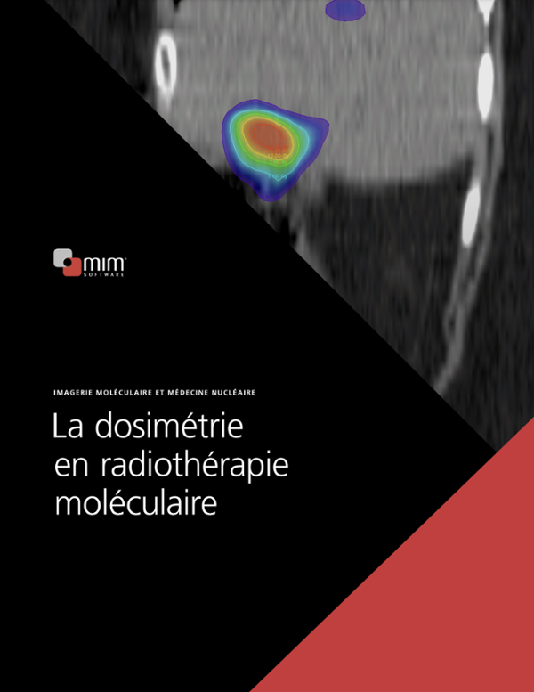 La Dosimétrie en Radiothérapie Moléculaire - MIM SurePlan™ MRT (PDF)