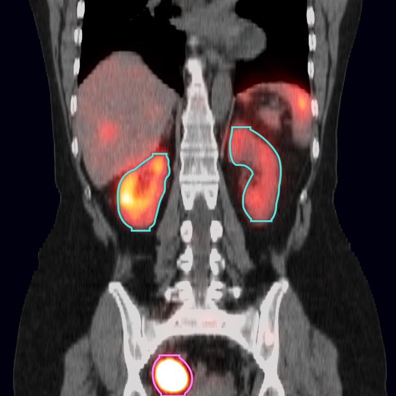 X-Ray image of a person's abdomen. 