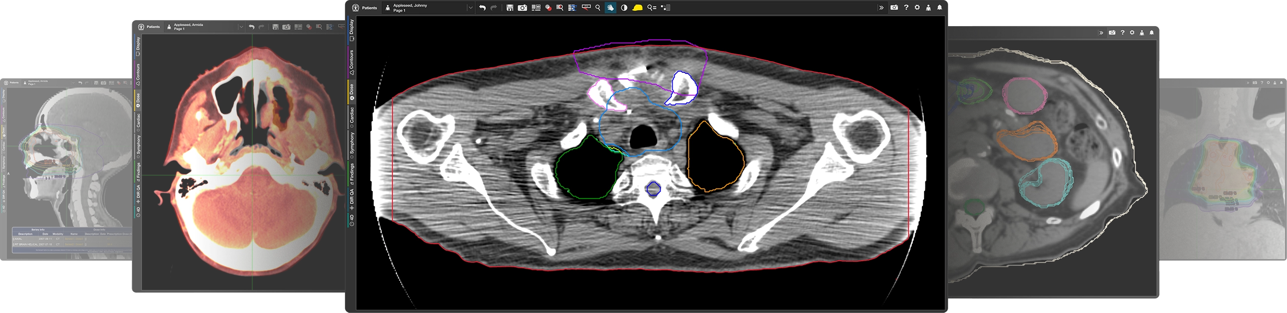 5 medical images centered in a row, showcasing the MIM Maestro interface